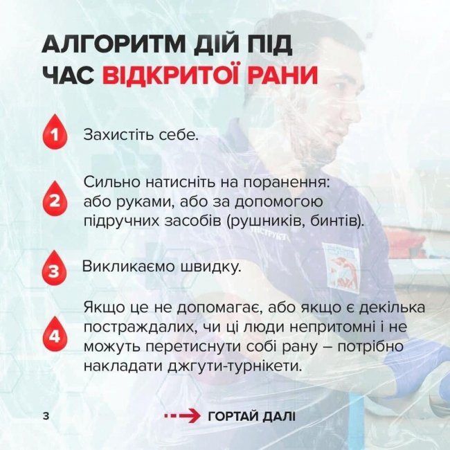 Як надати першу медичну допомогу. Покрокові інструкції