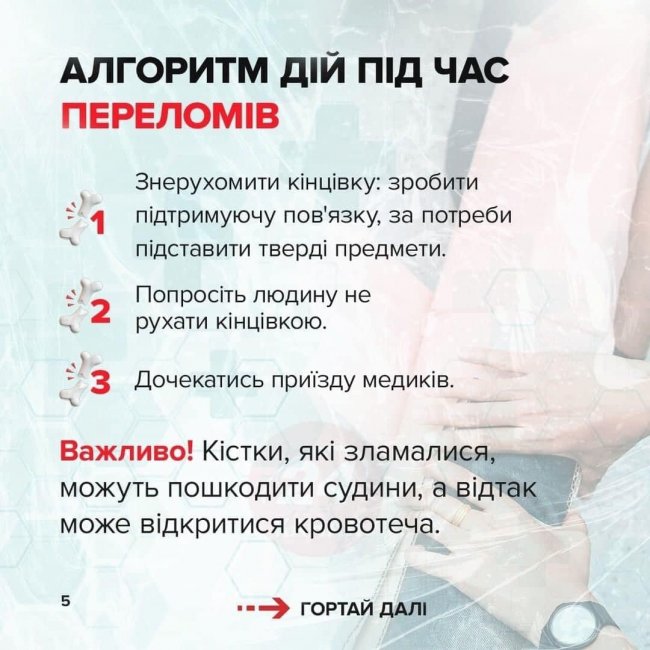 Як надати першу медичну допомогу. Покрокові інструкції